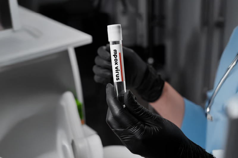 New Mpox Variant in China